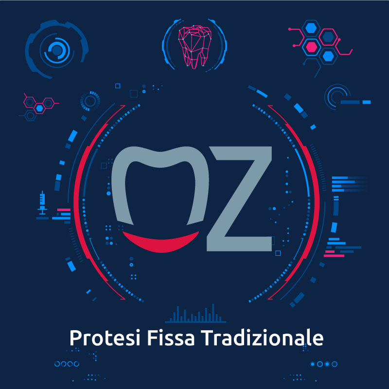 Protesi Fissa Tradizionale – Soluzioni Odontotecniche di Alta Precisione