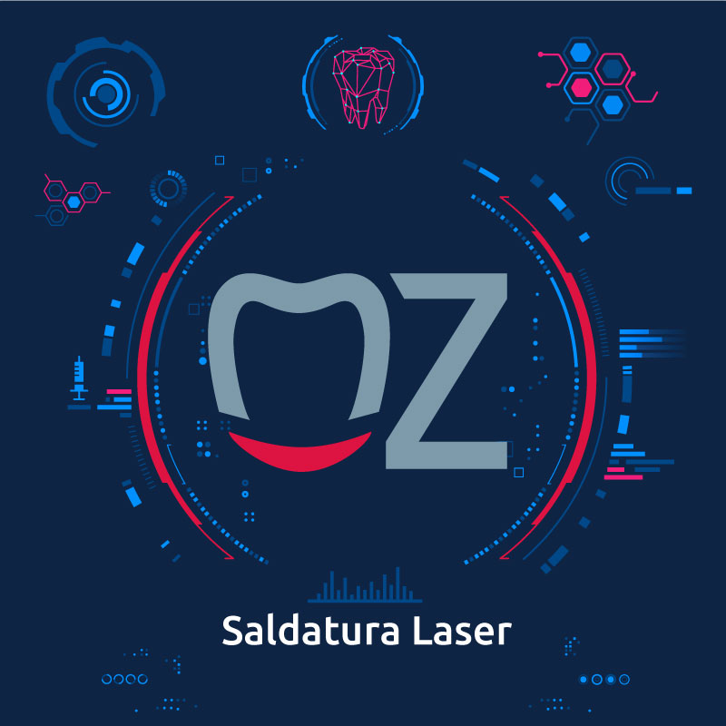 Saldatura Laser odontotecnica